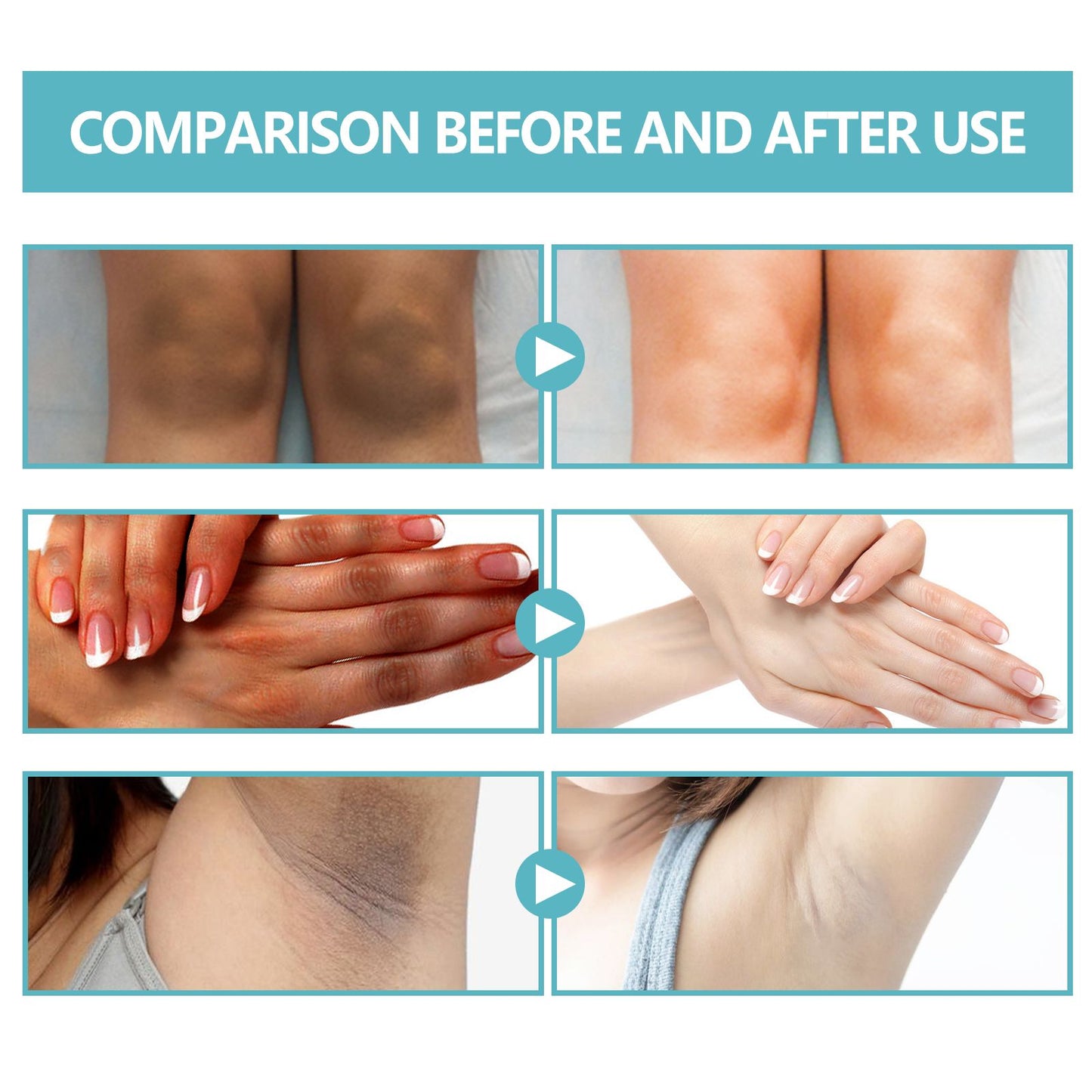 EELHOE Black Echinacea Repair Cream Repair Underarms Arms Knees Joints Dark Moisturizing Whitening Body Cream