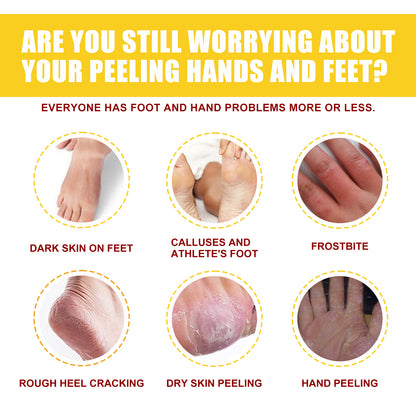 EELHOE Horse Oil Hand And Foot Repair Cream, Chapped Skin Care Moisturizing And Anti-Peeling Repair Cream