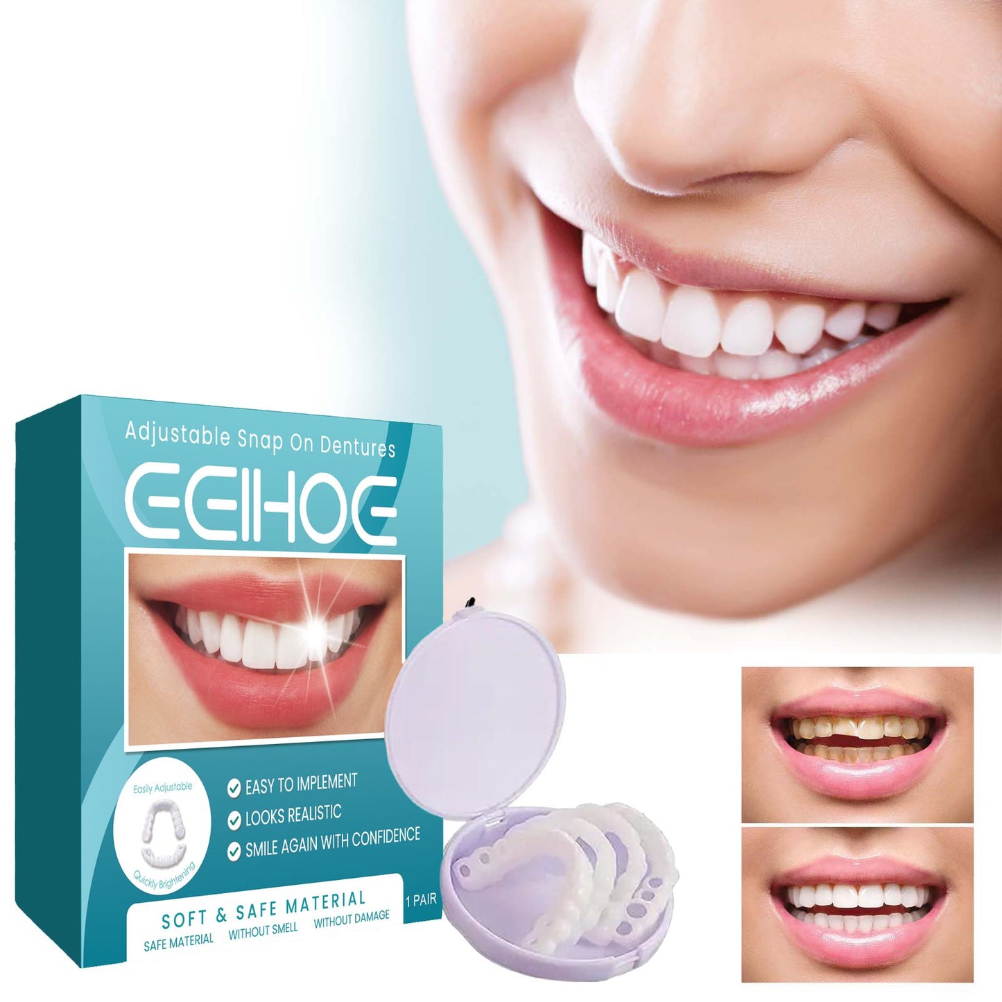 EELHOE Adjustable Snap On Dentures Temporary Gap Filling Orthodontic Dentures Kit