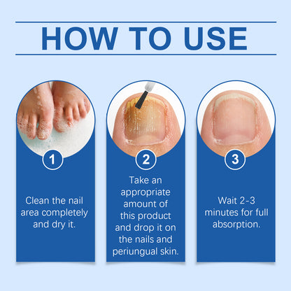 South Moon Nail Care Essence, Clean Fingernails Odor Soft Nail Groove Moisturizing Nail Care Solution