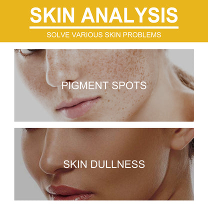 Wiyun V7 Whitening Cream Reduces Wrinkles And Fine Lines On The Face, Moisturizes And Brightens Skin, Anti-Aging And Replenishing Cream