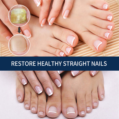 West&Month Nail Repair Relieve Essence Pen, Moisturizing Repair Hand And Foot Inlay Nail Thickening Grey Nail Correction Pen