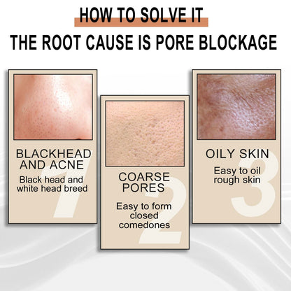 Jaysuing Lactobionic Acid Liquid Exfoliating Blackheads Shrinking Pores Cleansing Moisturizing Skin