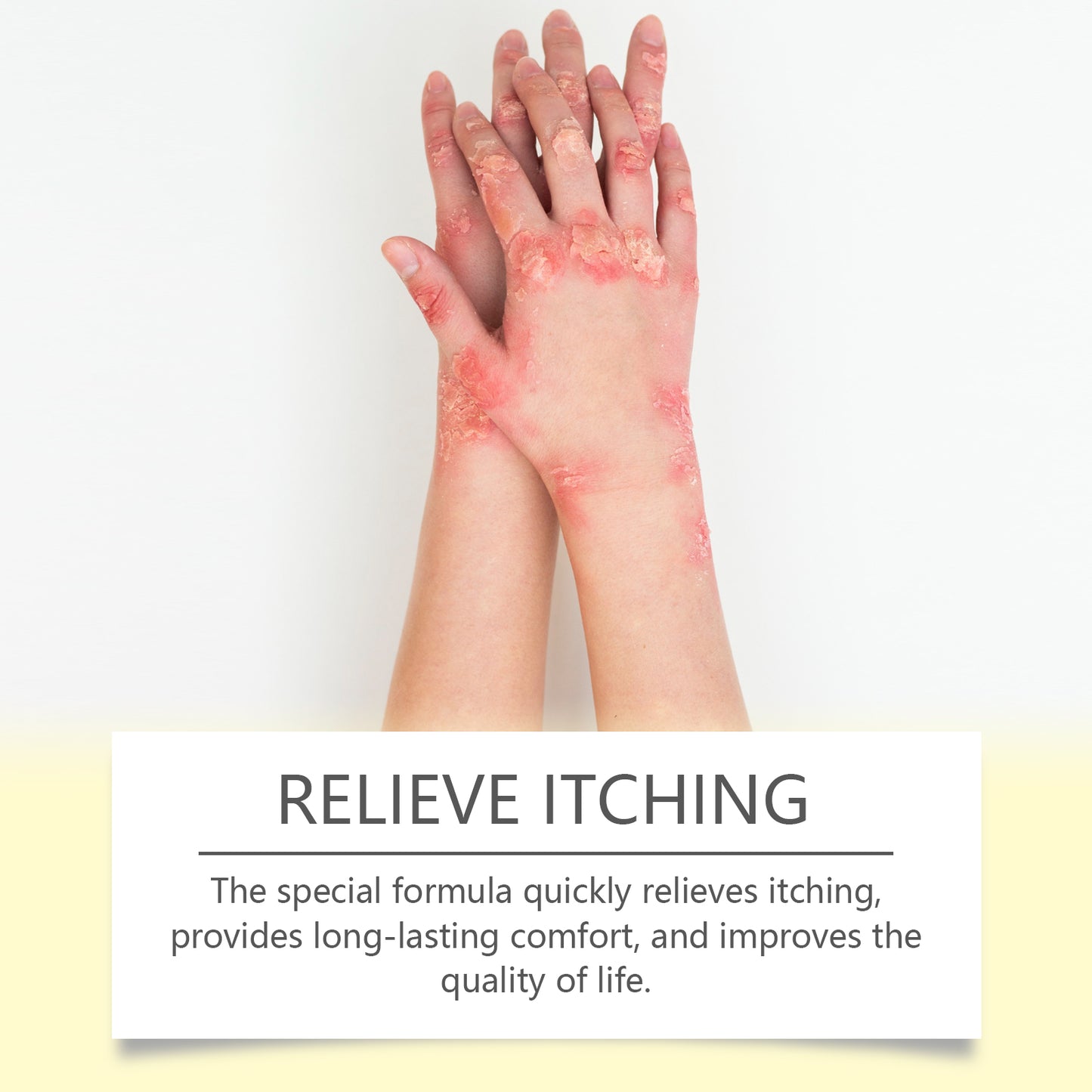 South Moon Skin Repair Cream, Skin Repair Cream For The Body And Hands And Feet