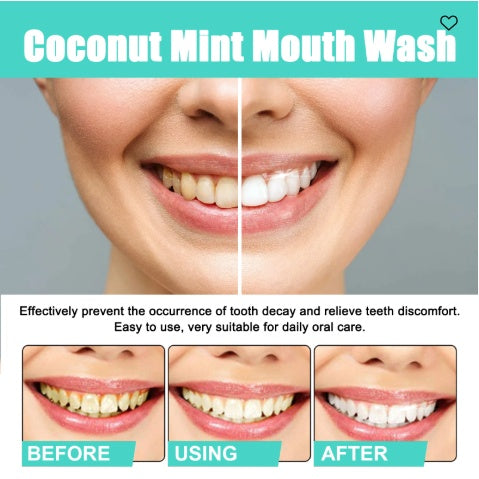 Oralhoe Coconut Mint Mouth Wash, Whitening Teeth Yellow Teeth Stains Tongue Coating Clean  Breath Oral Care