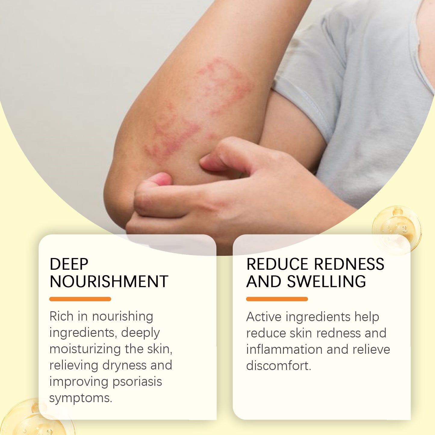 South Moon Skin Repair Cream, Skin Repair Cream For The Body And Hands And Feet