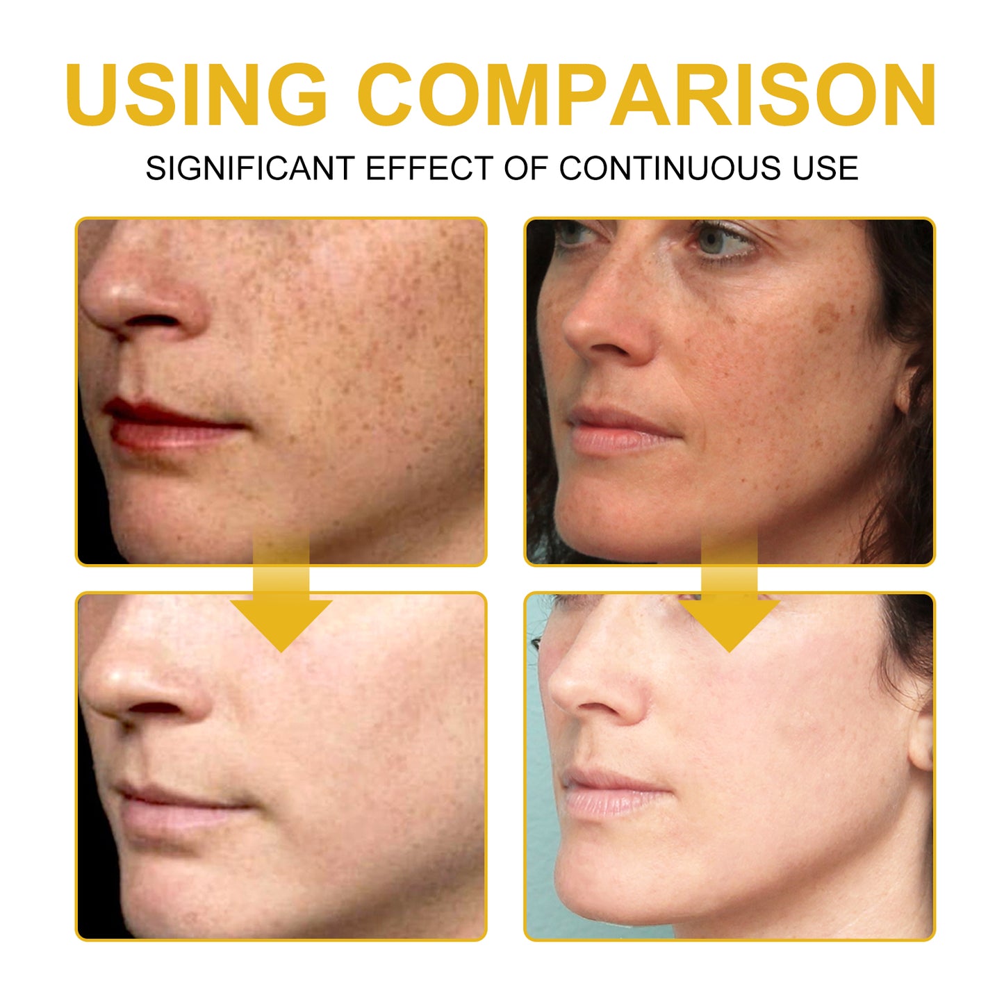 Wiyun V7 Whitening Cream Reduces Wrinkles And Fine Lines On The Face, Moisturizes And Brightens Skin, Anti-Aging And Replenishing Cream